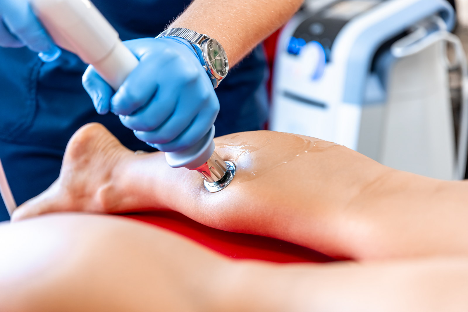 Udarni val (Shockwave terapija) Terapija z udarnimi valovi (ESWT – Extracorporeal Shock Wave Therapy)