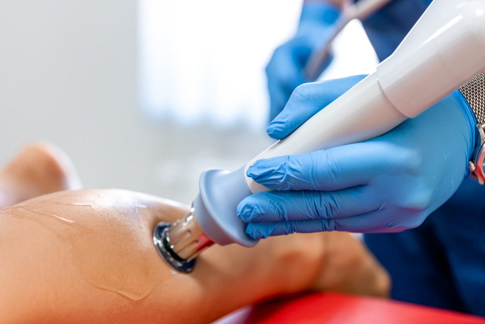Udarni val (Shockwave terapija) Terapija z udarnimi valovi (ESWT – Extracorporeal Shock Wave Therapy)